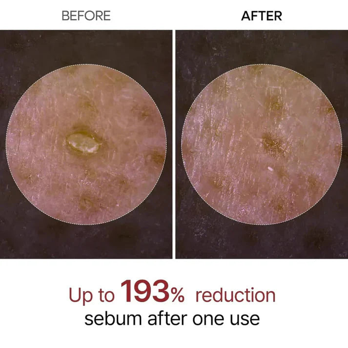 Dr. Melaxin Peel Shot Ampoule – Radiance in a Bottle