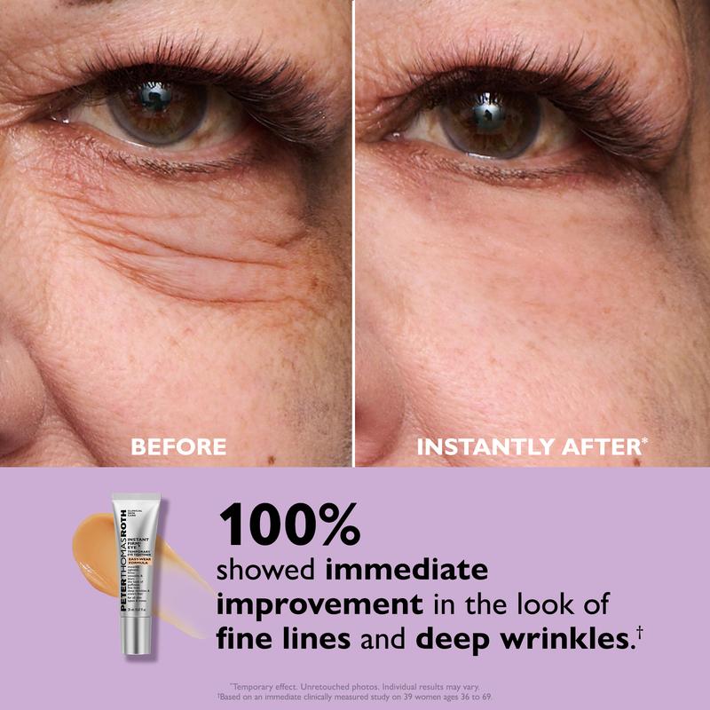 EyeLift™ Instant Eye Tightener – Look Younger in Minutes, Lasts All Day