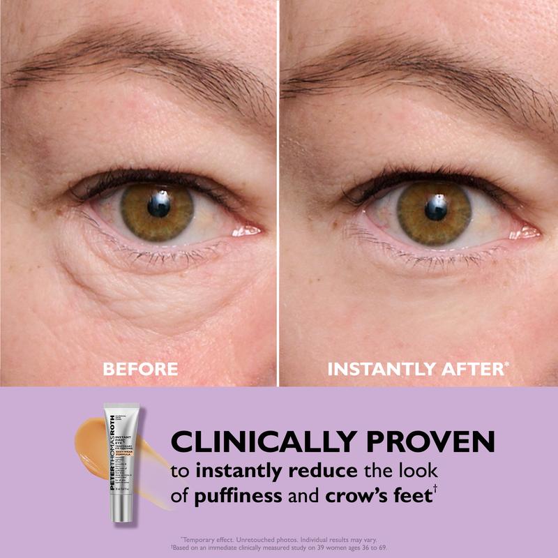 EyeLift™ Instant Eye Tightener – Look Younger in Minutes, Lasts All Day