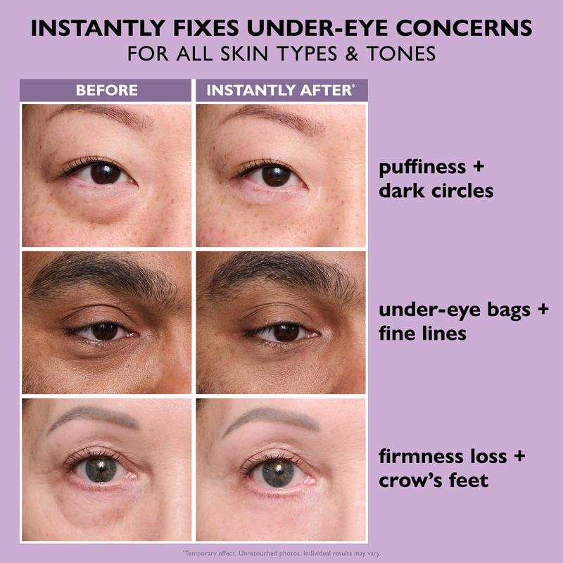 EyeLift™ Instant Eye Tightener – Look Younger in Minutes, Lasts All Day